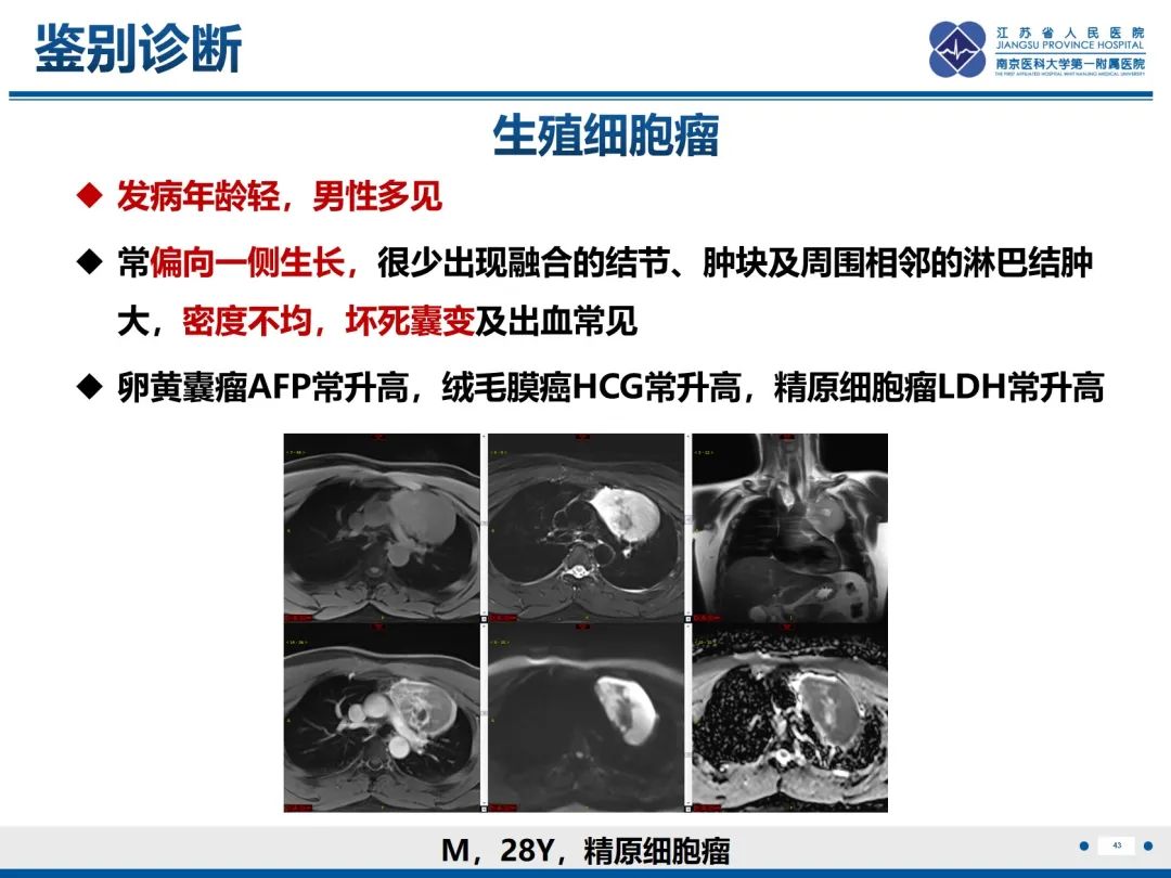 影像PPT - 【PPT】神经纤维瘤病1型-43