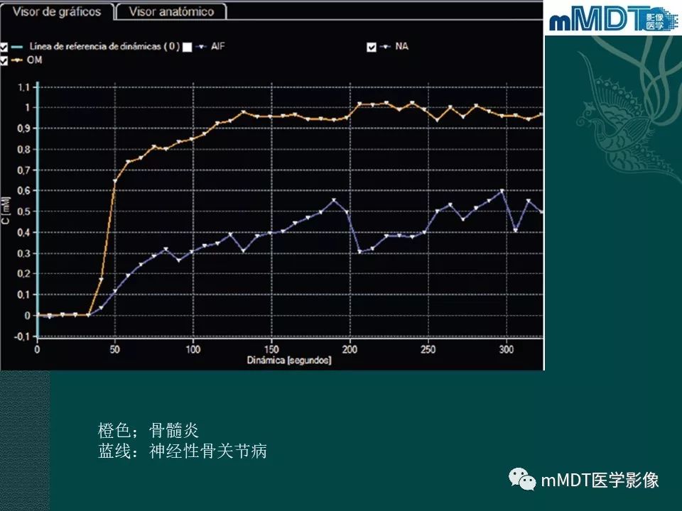 影像PPT - 【PPT】磁共振新技术鉴别糖尿病足的神经性骨关节病和骨髓炎-33