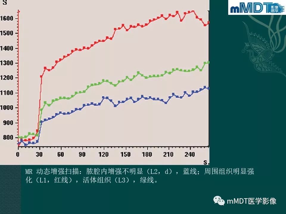 影像PPT - 【PPT】磁共振新技术鉴别糖尿病足的神经性骨关节病和骨髓炎-40