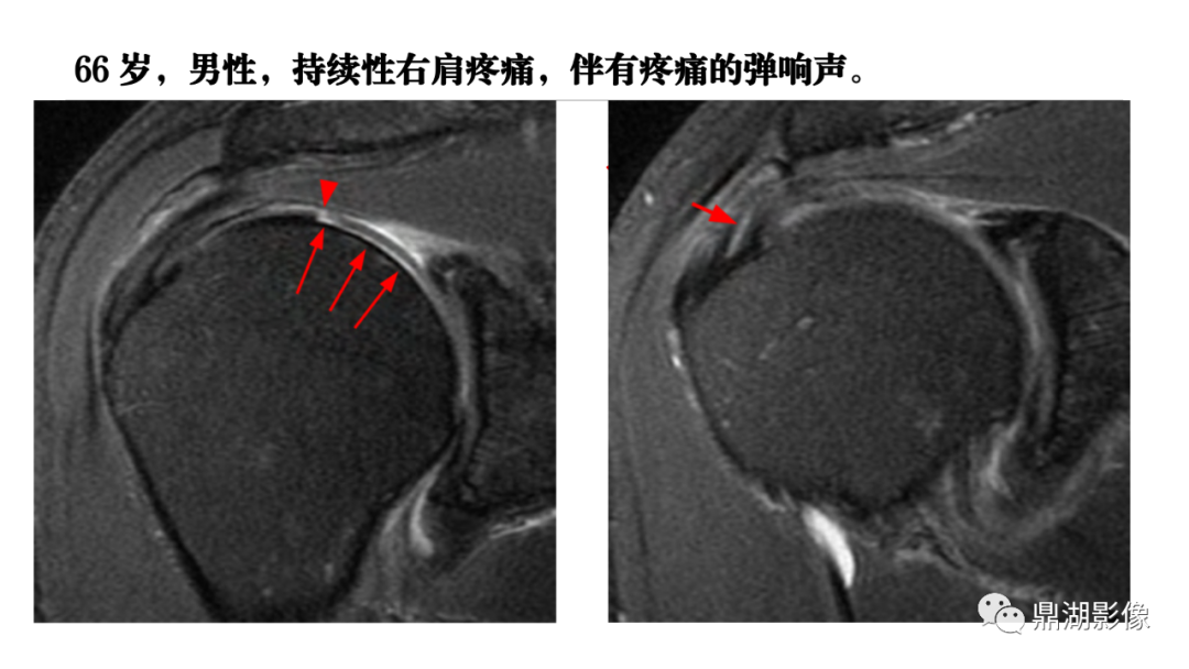 影像PPT - 【PPT】MR诊断骨关节里的组织分层-1 影像PPT - 【PPT】MR诊断骨关节里的组织分层-1