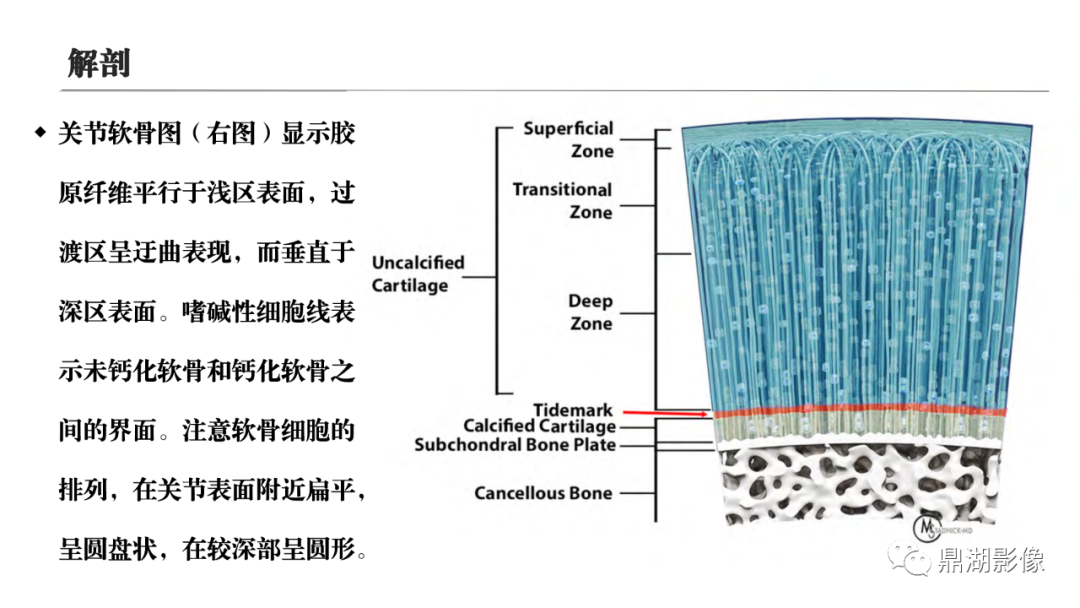 影像PPT - 【PPT】MR诊断骨关节里的组织分层-6 影像PPT - 【PPT】MR诊断骨关节里的组织分层-6