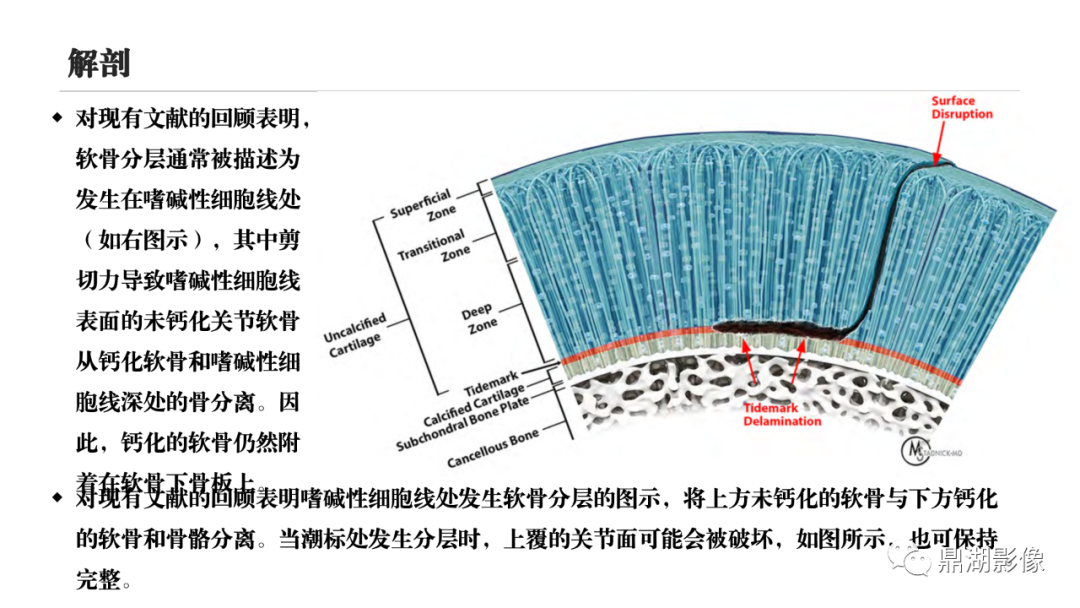 影像PPT - 【PPT】MR诊断骨关节里的组织分层-8 影像PPT - 【PPT】MR诊断骨关节里的组织分层-8