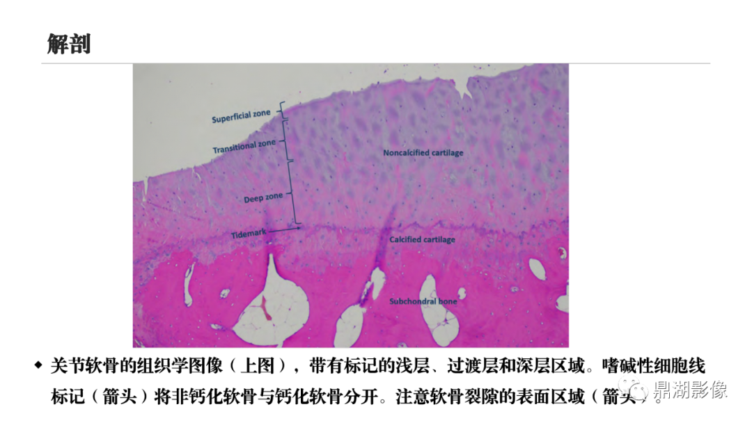 影像PPT - 【PPT】MR诊断骨关节里的组织分层-7 影像PPT - 【PPT】MR诊断骨关节里的组织分层-7