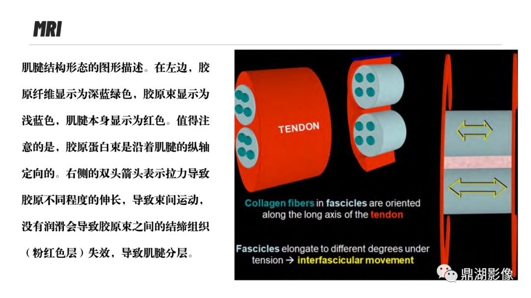 影像PPT - 【PPT】MR诊断骨关节里的组织分层-34 影像PPT - 【PPT】MR诊断骨关节里的组织分层-34
