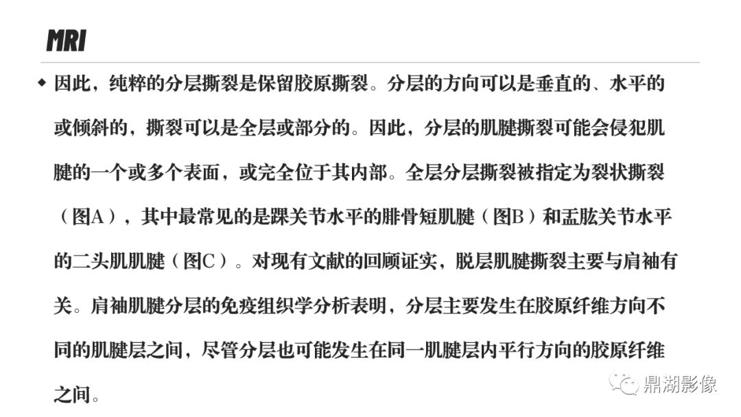 影像PPT - 【PPT】MR诊断骨关节里的组织分层-35 影像PPT - 【PPT】MR诊断骨关节里的组织分层-35