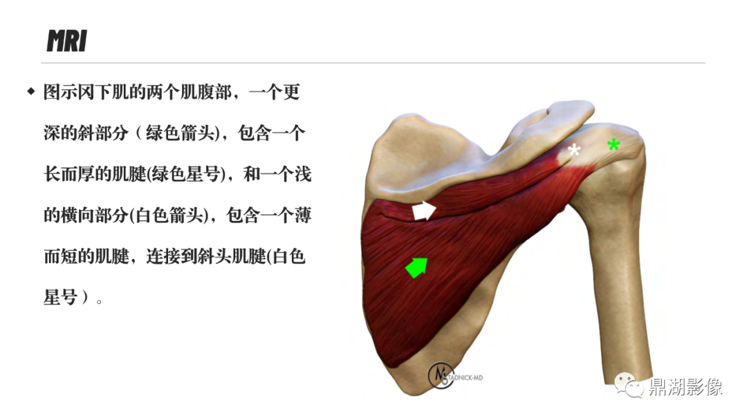 影像PPT - 【PPT】MR诊断骨关节里的组织分层-45 影像PPT - 【PPT】MR诊断骨关节里的组织分层-45