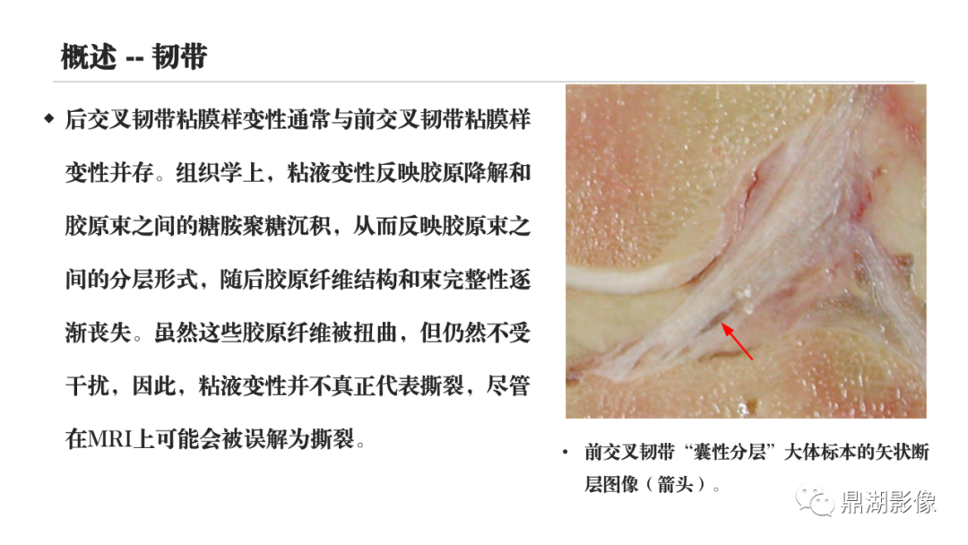 影像PPT - 【PPT】MR诊断骨关节里的组织分层-50 影像PPT - 【PPT】MR诊断骨关节里的组织分层-50
