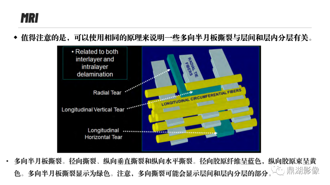 影像PPT - 【PPT】MR诊断骨关节里的组织分层-72 影像PPT - 【PPT】MR诊断骨关节里的组织分层-72
