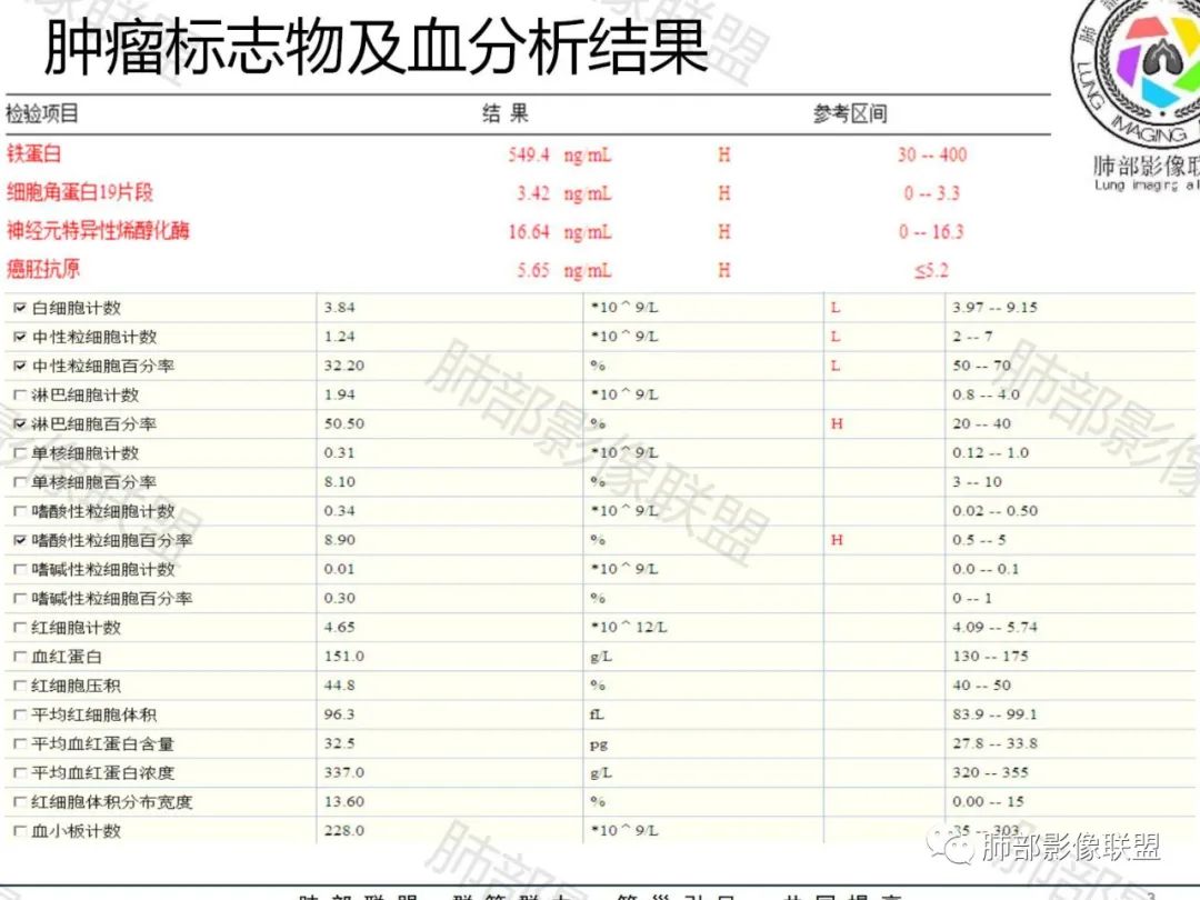 影像PPT - 【病例】PSP与类癌之辩-3