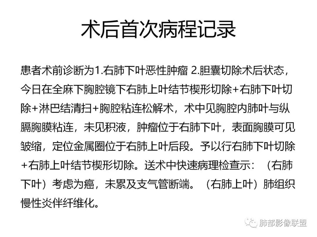影像PPT - 【病例】PSP与类癌之辩-58