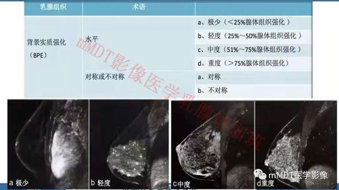 影像PPT - 【PPT】乳腺MRI诊断-15 影像PPT - 【PPT】乳腺MRI诊断-15