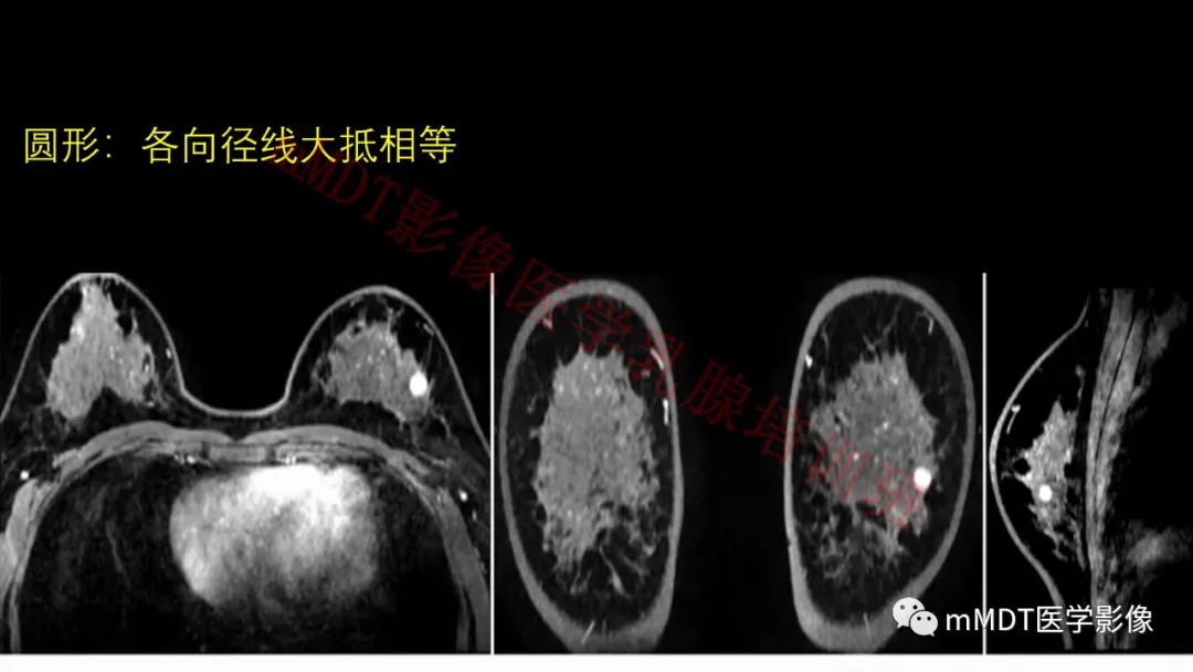 影像PPT - 【PPT】乳腺MRI诊断-37 影像PPT - 【PPT】乳腺MRI诊断-37