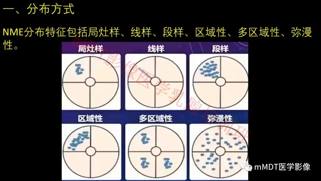 影像PPT - 【PPT】乳腺MRI诊断-58 影像PPT - 【PPT】乳腺MRI诊断-58