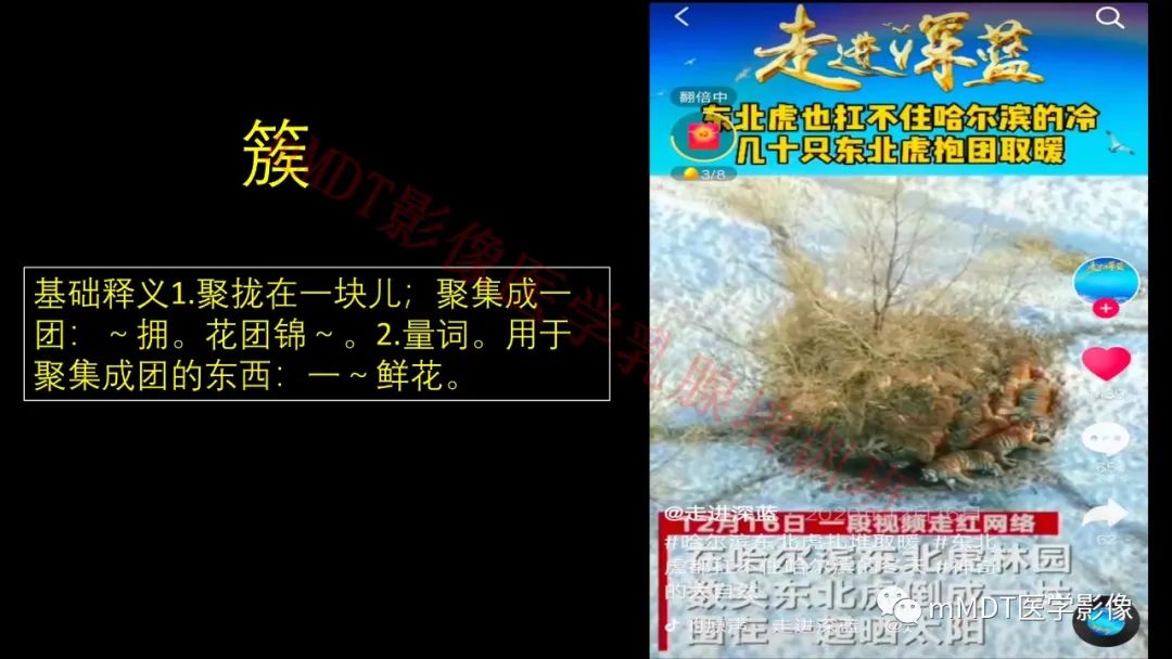 影像PPT - 【PPT】乳腺MRI诊断-71 影像PPT - 【PPT】乳腺MRI诊断-71