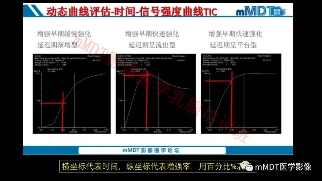 影像PPT - 【PPT】乳腺MRI诊断-96 影像PPT - 【PPT】乳腺MRI诊断-96
