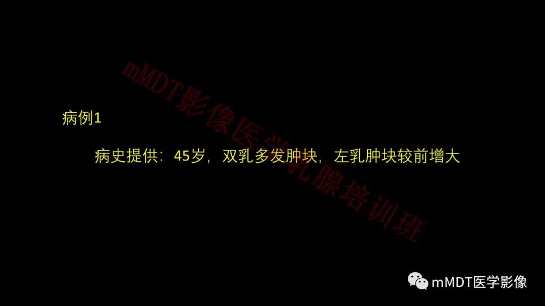 影像PPT - 【PPT】乳腺MRI诊断-101 影像PPT - 【PPT】乳腺MRI诊断-101