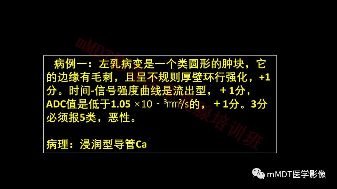 影像PPT - 【PPT】乳腺MRI诊断-116 影像PPT - 【PPT】乳腺MRI诊断-116