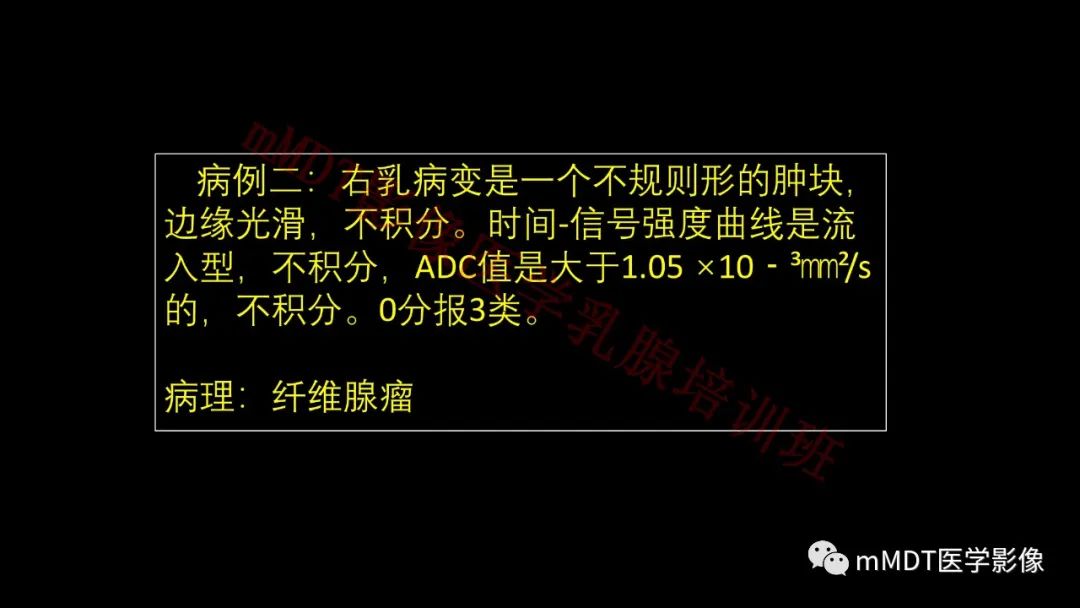 影像PPT - 【PPT】乳腺MRI诊断-127 影像PPT - 【PPT】乳腺MRI诊断-127