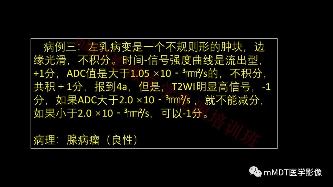 影像PPT - 【PPT】乳腺MRI诊断-139 影像PPT - 【PPT】乳腺MRI诊断-139