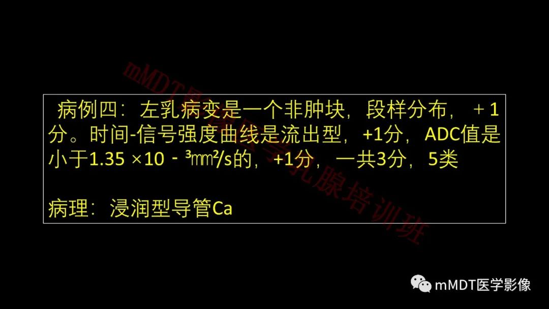 影像PPT - 【PPT】乳腺MRI诊断-153 影像PPT - 【PPT】乳腺MRI诊断-153