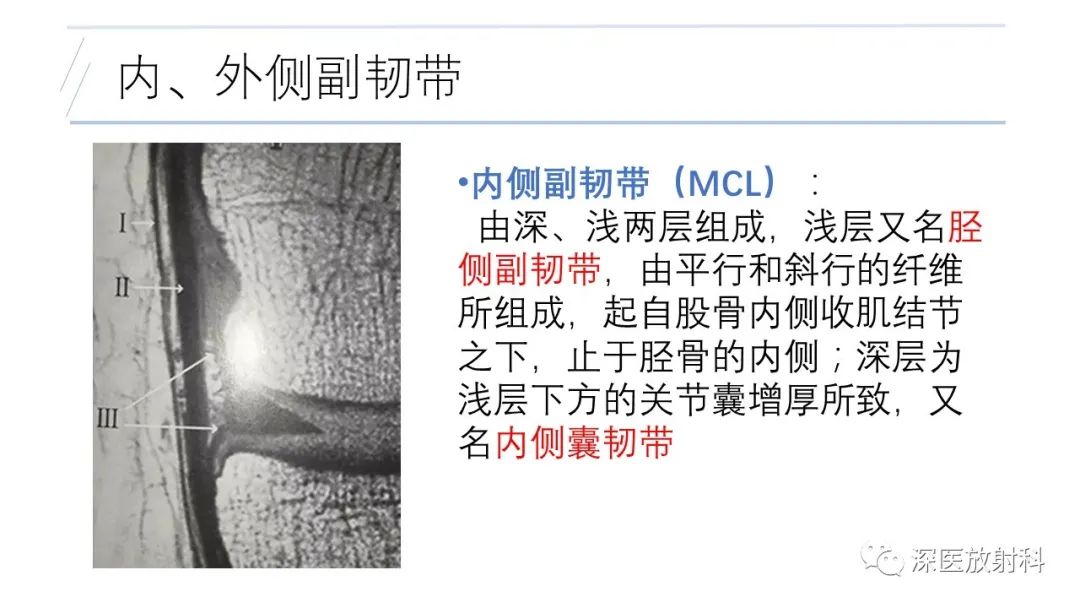 影像PPT - 【PPT】膝关节解剖变异的影像诊断-10
