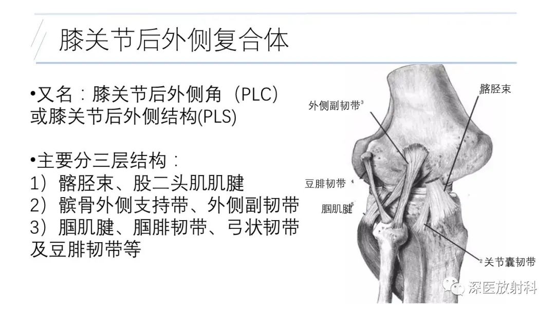 影像PPT - 【PPT】膝关节解剖变异的影像诊断-12