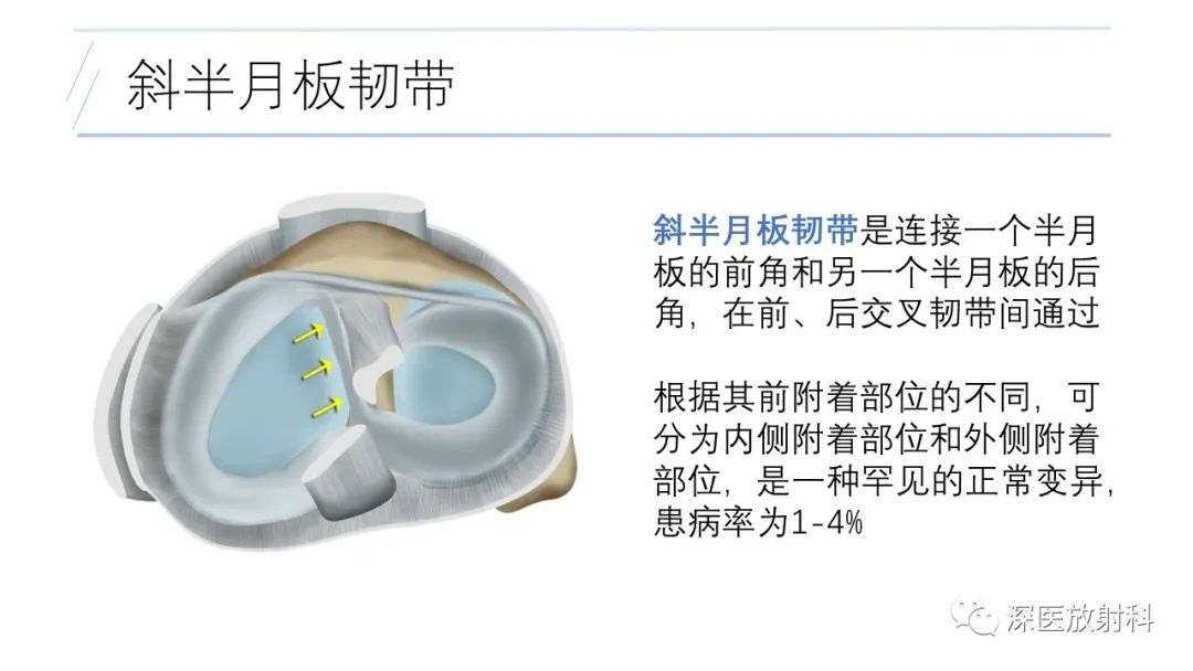 影像PPT - 【PPT】膝关节解剖变异的影像诊断-36