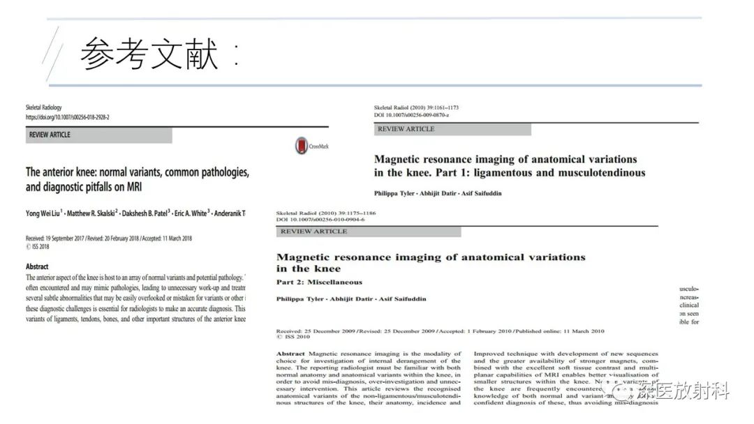 影像PPT - 【PPT】膝关节解剖变异的影像诊断-47