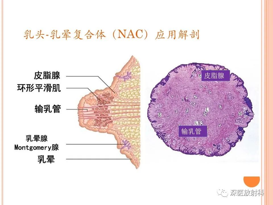 影像PPT - 乳腺MRI乳头强化及影像-病理的相关性-4