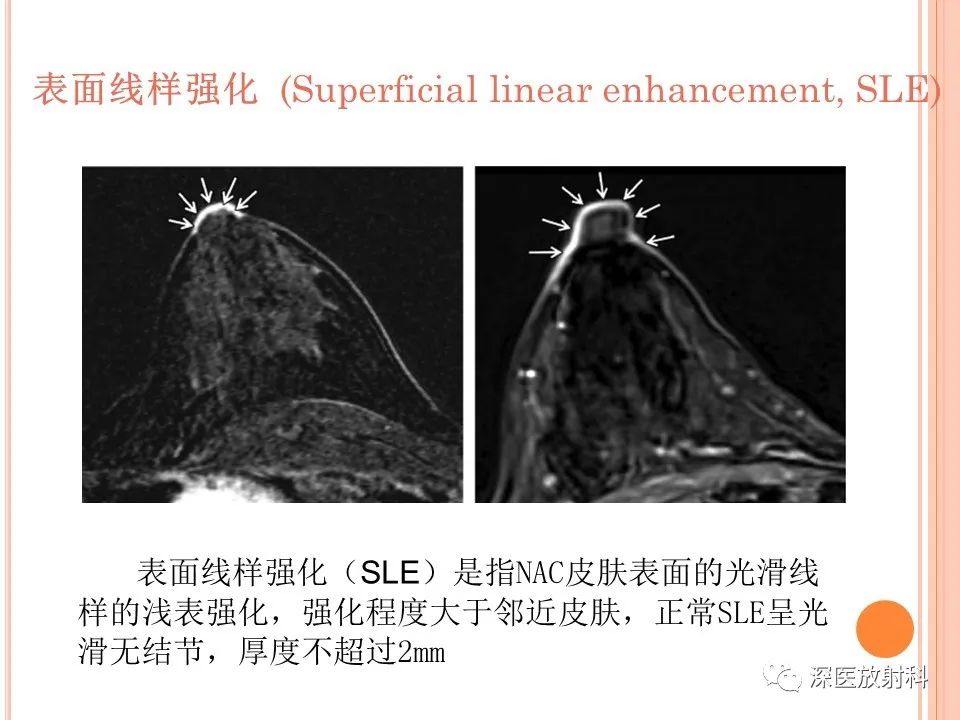 影像PPT - 乳腺MRI乳头强化及影像-病理的相关性-10
