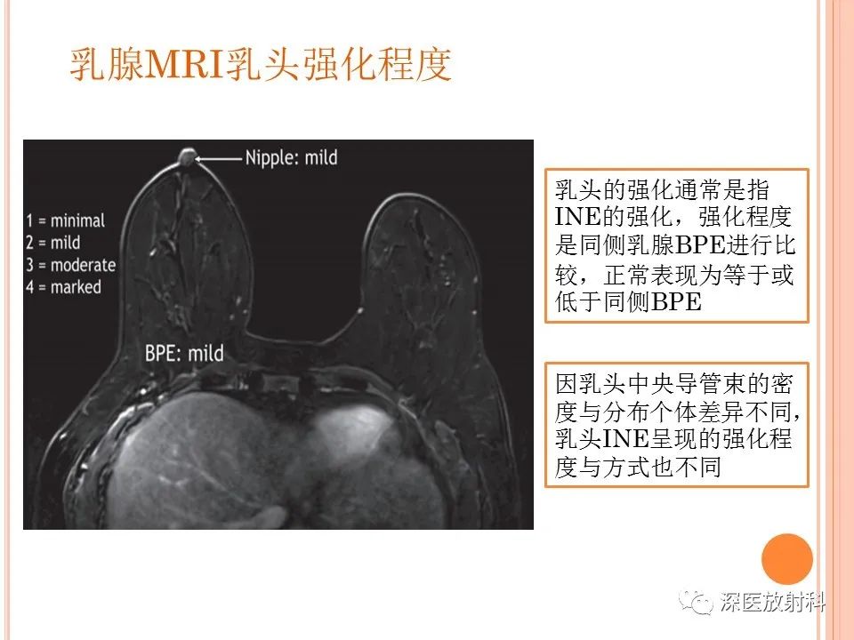 影像PPT - 乳腺MRI乳头强化及影像-病理的相关性-15