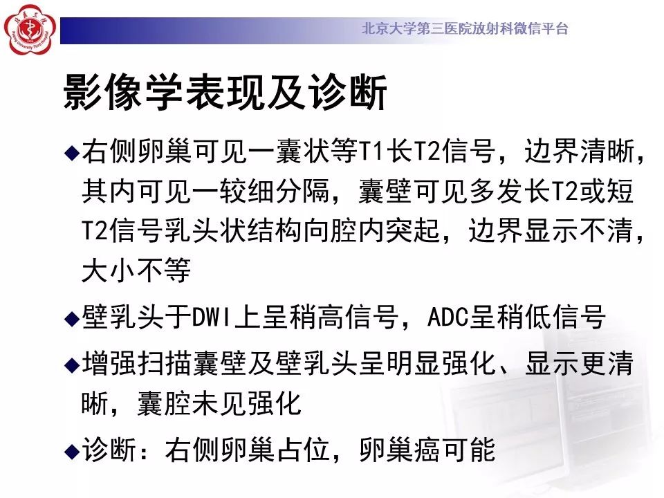影像PPT - 【PPT】卵巢交界性肿瘤影像诊断-7