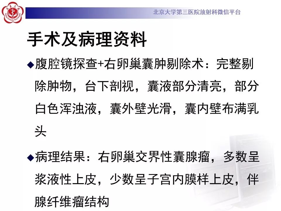 影像PPT - 【PPT】卵巢交界性肿瘤影像诊断-8