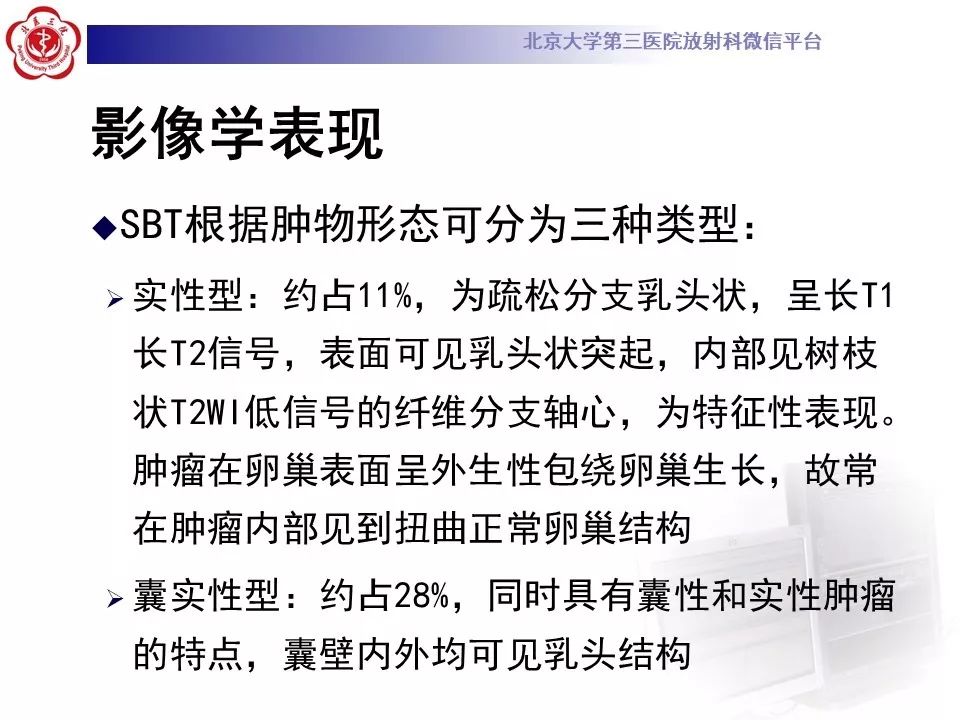 影像PPT - 【PPT】卵巢交界性肿瘤影像诊断-17