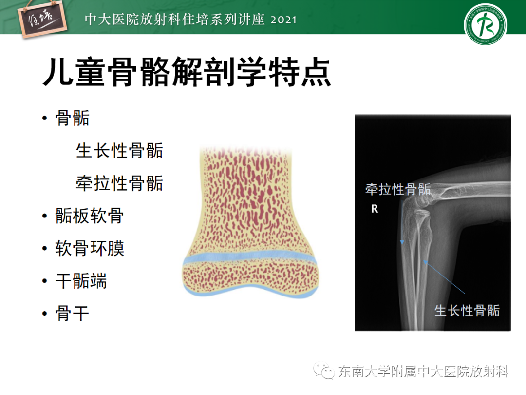 影像PPT - 【PPT】儿童骨关节损伤-5