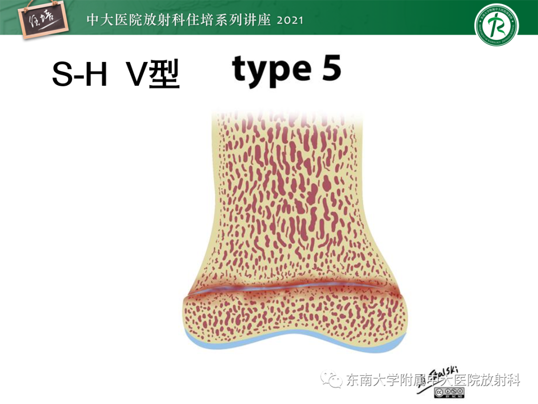 影像PPT - 【PPT】儿童骨关节损伤-19