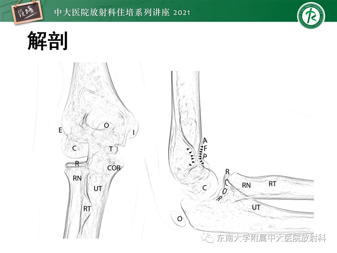 影像PPT - 【PPT】儿童骨关节损伤-27