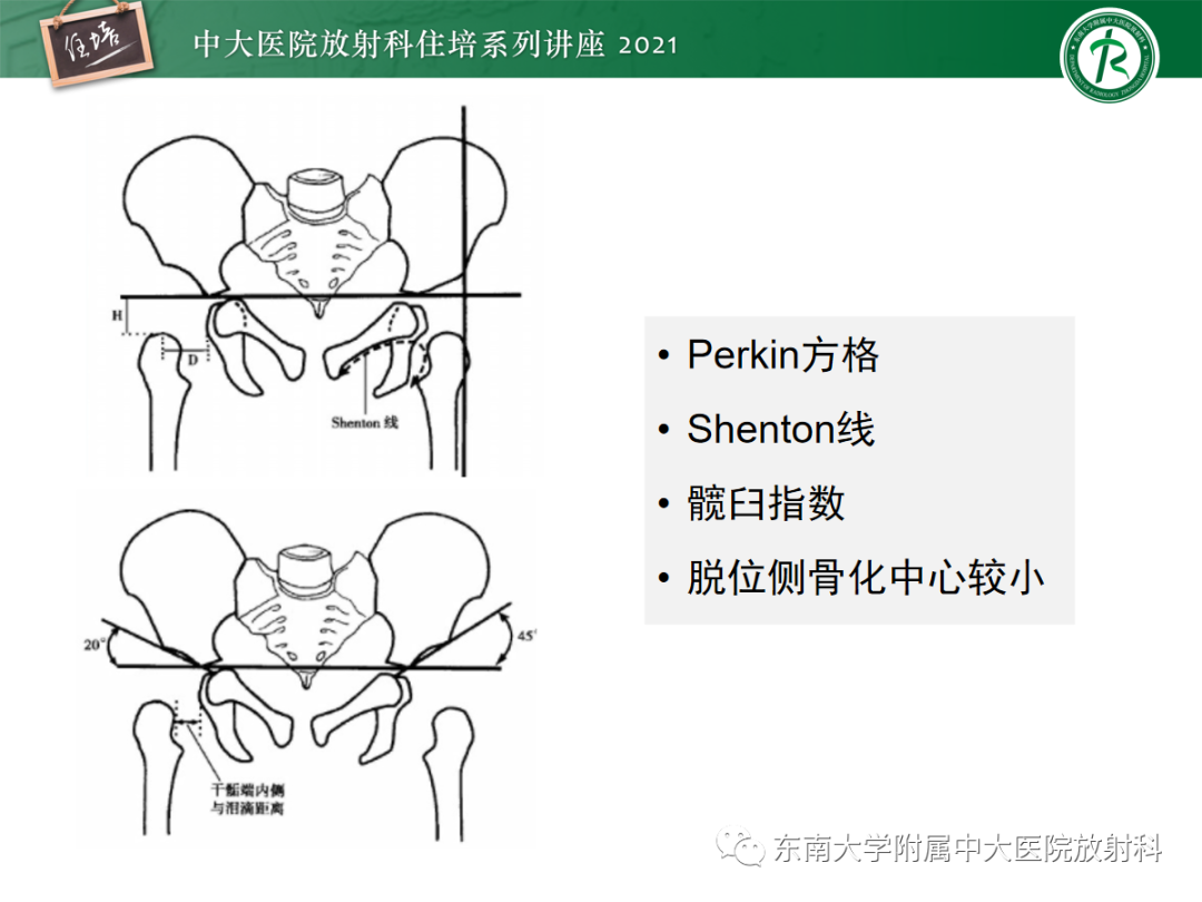 影像PPT - 【PPT】儿童骨关节损伤-70
