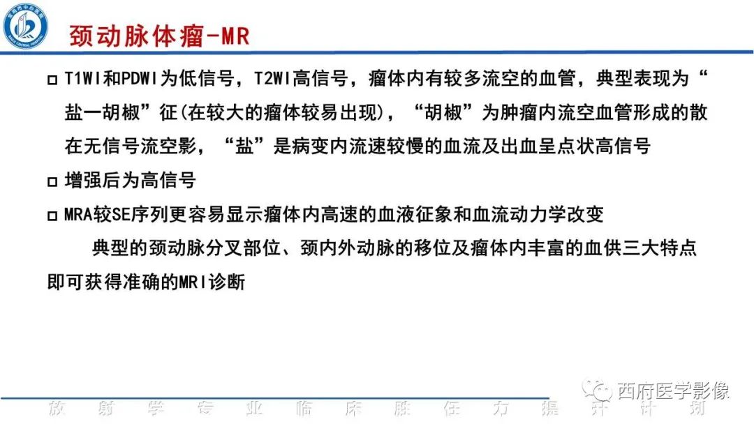 影像PPT - 【PPT】颈动脉体瘤的影像诊断-19