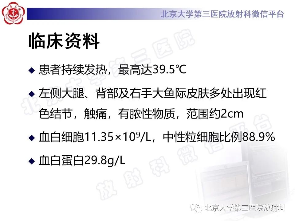 影像PPT - 【PPT】肺奴卡菌病-3