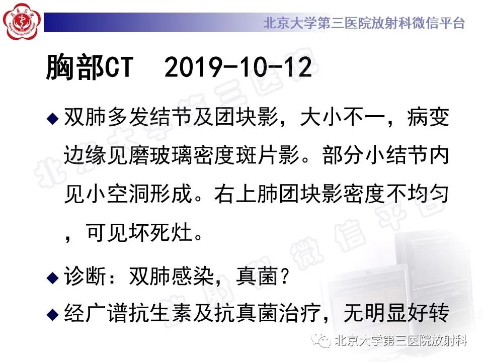 影像PPT - 【PPT】肺奴卡菌病-7