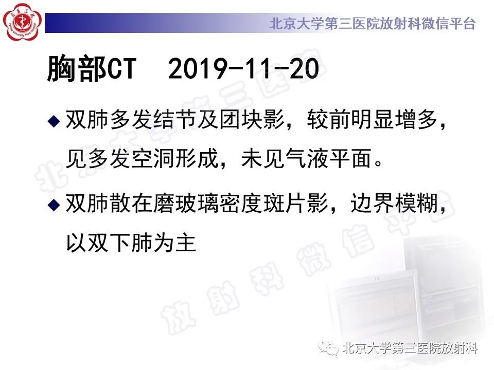 影像PPT - 【PPT】肺奴卡菌病-11
