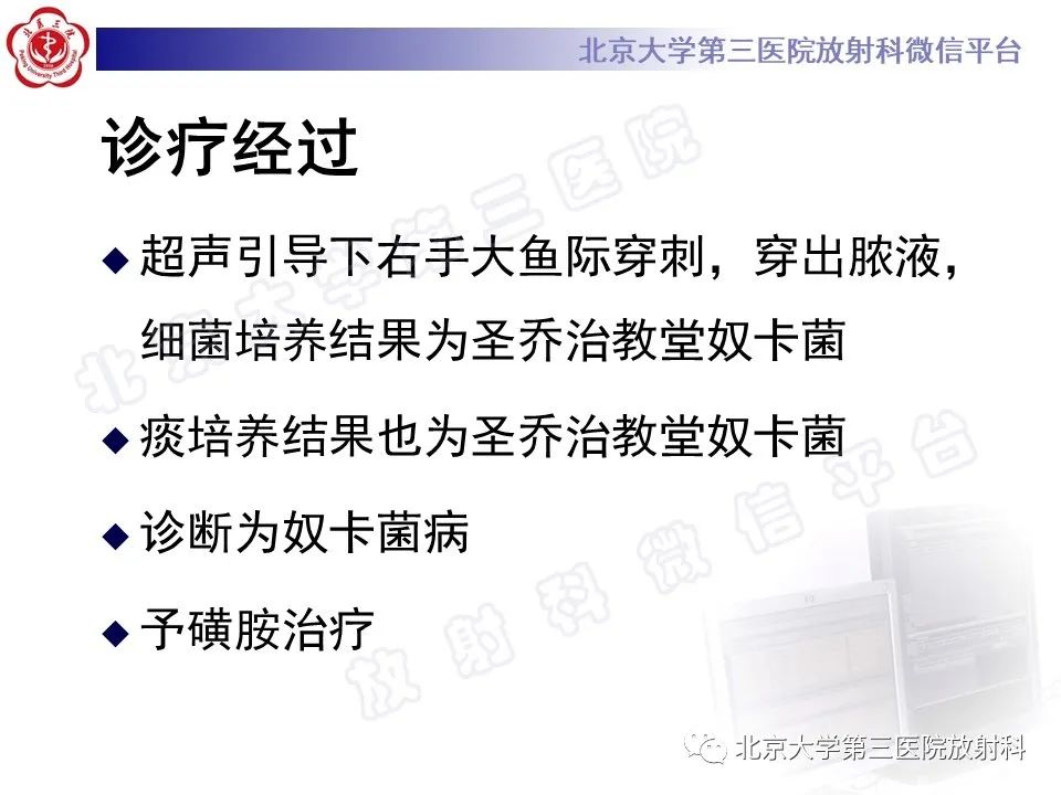 影像PPT - 【PPT】肺奴卡菌病-12
