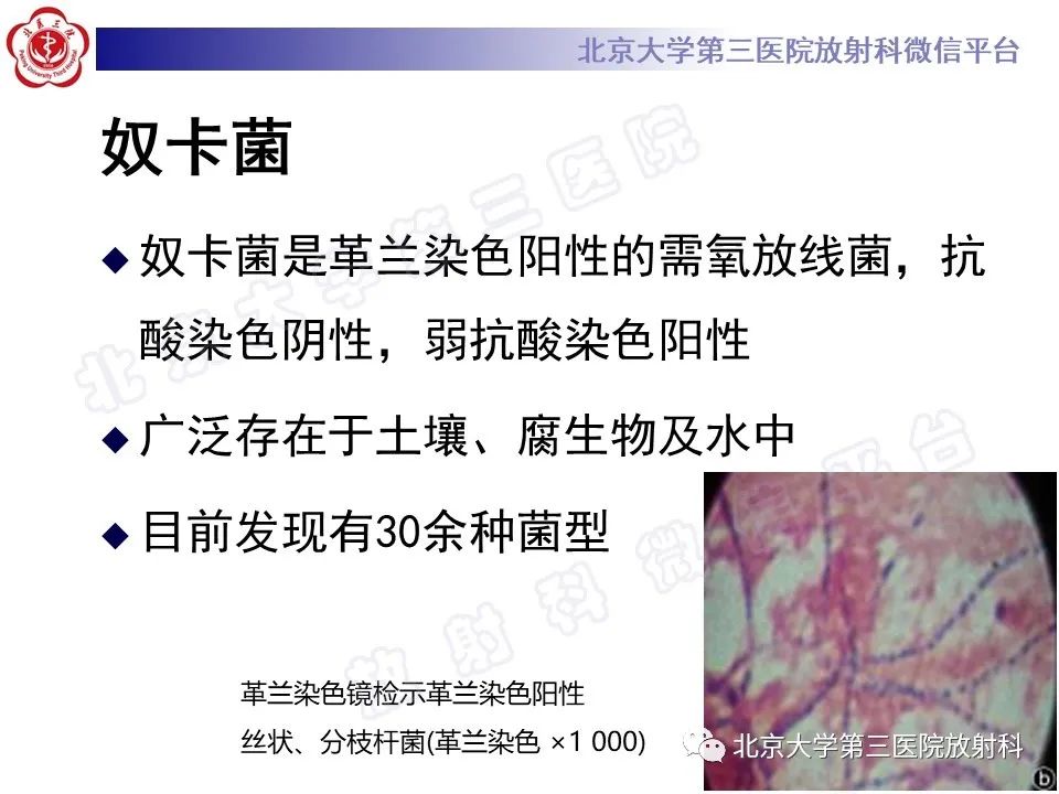 影像PPT - 【PPT】肺奴卡菌病-18