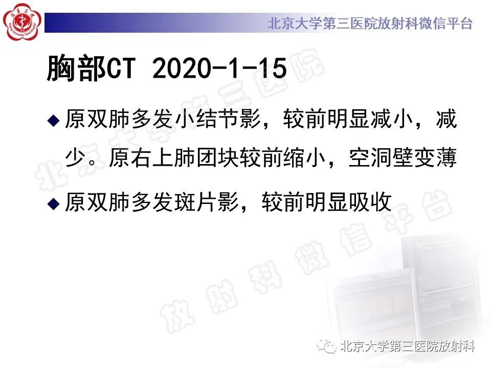 影像PPT - 【PPT】肺奴卡菌病-16