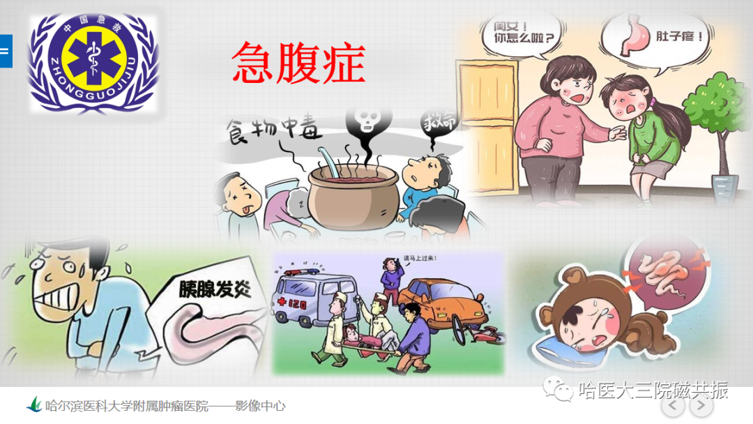 影像PPT - 【PPT】急腹症影像学诊断-2
