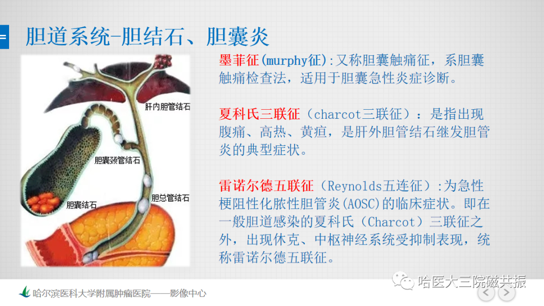 影像PPT - 【PPT】急腹症影像学诊断-8