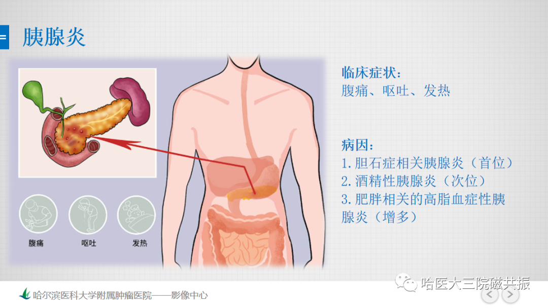 影像PPT - 【PPT】急腹症影像学诊断-13