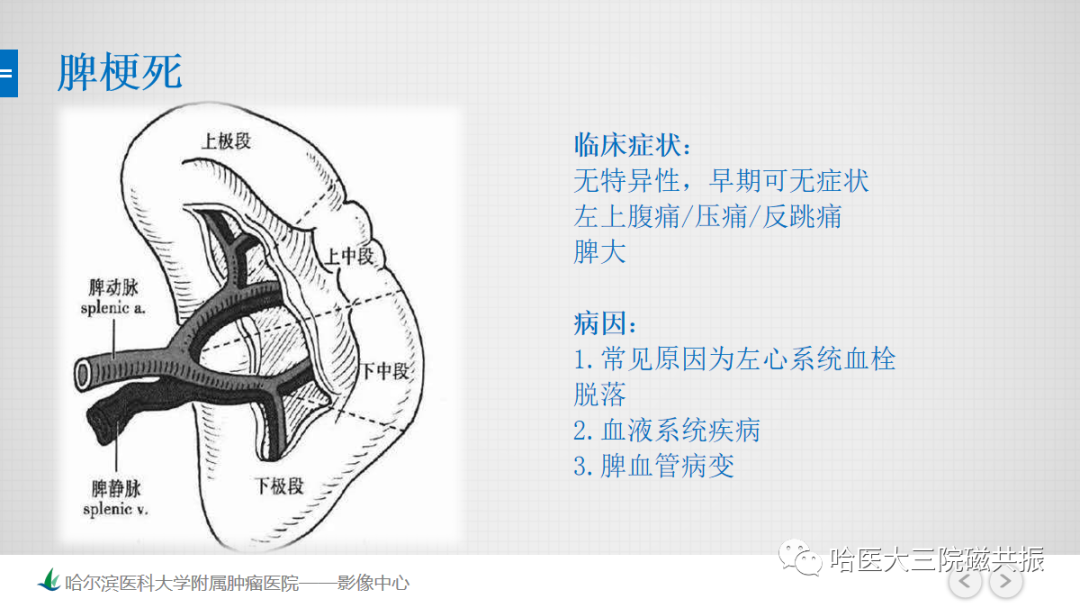 影像PPT - 【PPT】急腹症影像学诊断-17