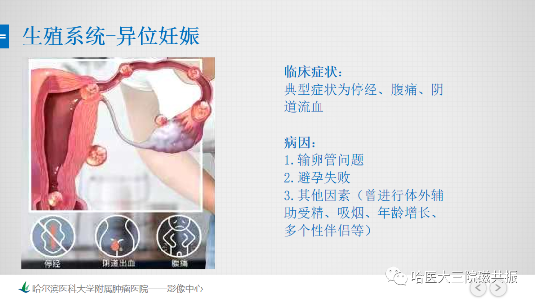 影像PPT - 【PPT】急腹症影像学诊断-25